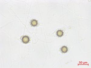 Pythium_uncinulatum_1