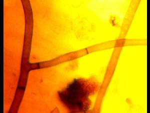 Rhizoctonia_solani_2