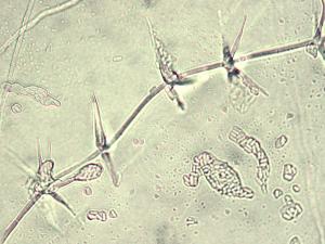 Verticillium_fungicola_1