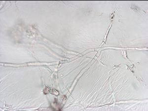 Sclerotium_cepivorum_4