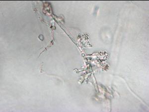 Sclerotium_cepivorum_3
