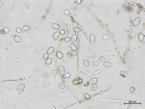 Phytophthora_infestans_5