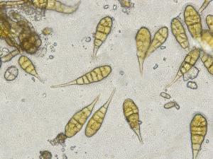 Alternaria_sp_4