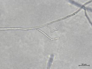 Aphanomyces_euteiches_4