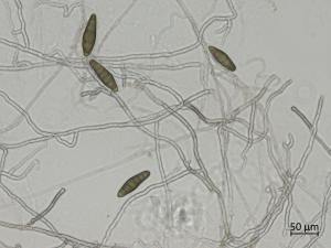 Bipolaris_sorokiniana_1