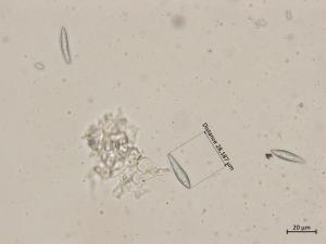 Botryosphaeria_dothidea_4