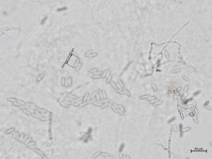 Colletotrichum_acutatum_5