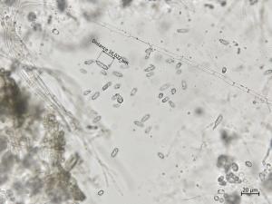 Colletotrichum_coccodes_9