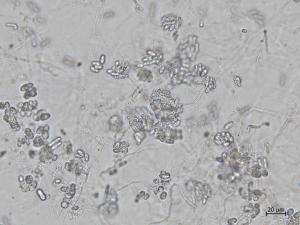 Colletotrichum_coccodes_8