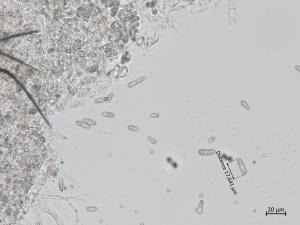 Colletotrichum_coccodes_7