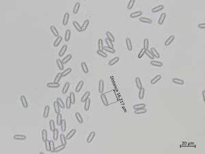 Colletotrichum_siamense_1