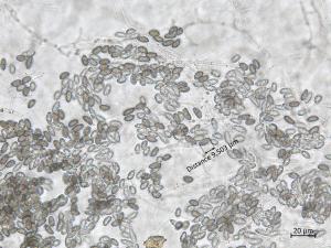 Coniella_diplodiella_2