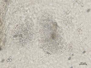 Coniella_diplodiella_5