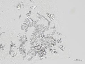 Dactylonectria_torresensis_2