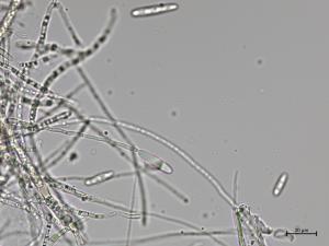 Dactylonectria_torresensis_4