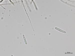 Dactylonectria_torresensis_5