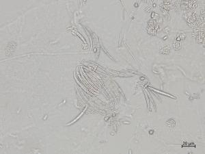 Fusarium_oxysporum_5
