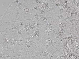 Fusarium_oxysporum_7