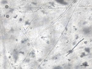 Globisporangium_irregulare_1