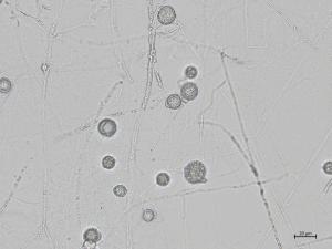 Globisporangium_irregulare_3