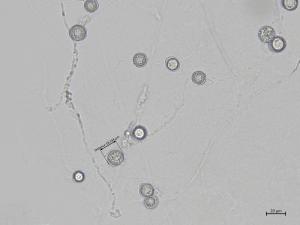 Globisporangium_irregulare_4