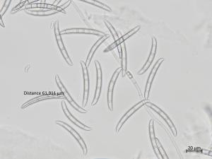 Neocosmospora_solani_1