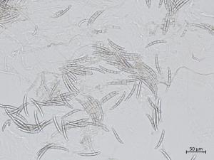 Neocosmospora_solani_2