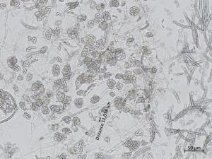 Neocosmospora_solani_3