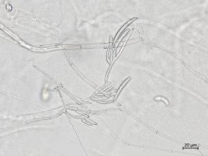 Neocosmospora_solani_5