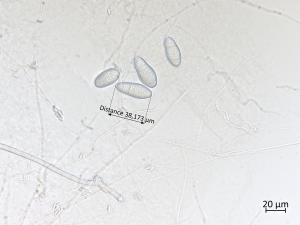 Orbilia_blumenaviensis_3