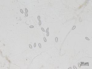 Orbilia_blumenaviensis_2