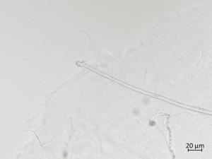 Orbilia_blumenaviensis_5