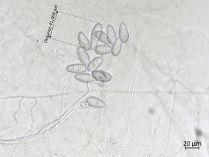 Orbilia_blumenaviensis_4