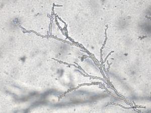 Phytophthora_cactorum_2