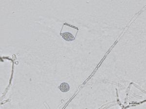 Phytophthora_cactorum_5