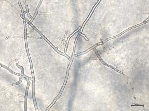 Rhizoctonia_solani_6