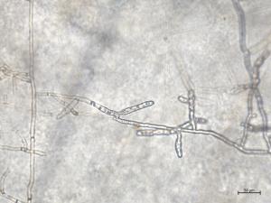 Rhizoctonia_solani_4