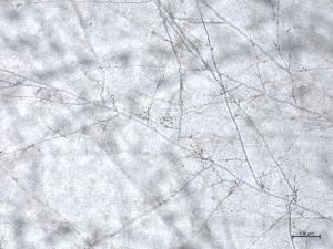 Rhizoctonia_solani_3