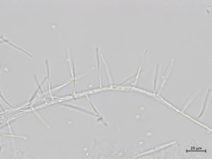 Sarocladium_strictum_1