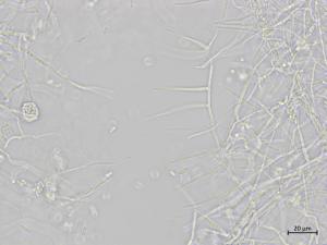 Sarocladium_strictum_2