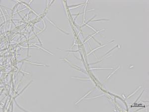 Sarocladium_strictum_4