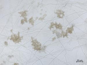 Sclerotinia_sclerotiorum_4