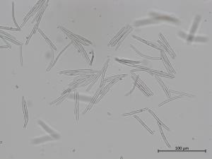 Cercospora_sp_2