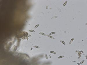 Paraconiothyrium coniothyrium