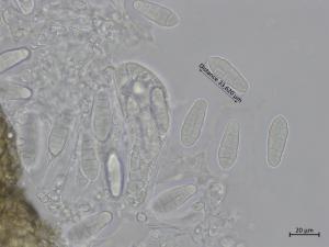 Leptosphaerulina sp. 