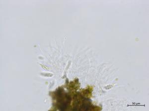 Colletotrichum_boninense_4