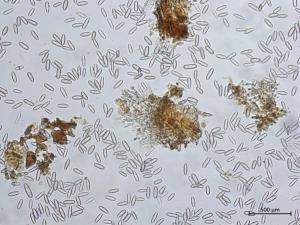 Colletotrichum_fioriniae_5