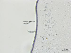 Colletotrichum_incanum_2