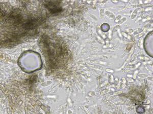 Colletotrichum_petchii_1