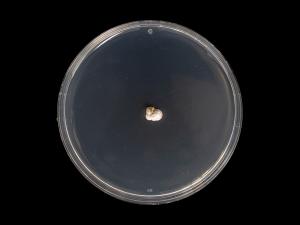 Diplocarpon_fragariae_2